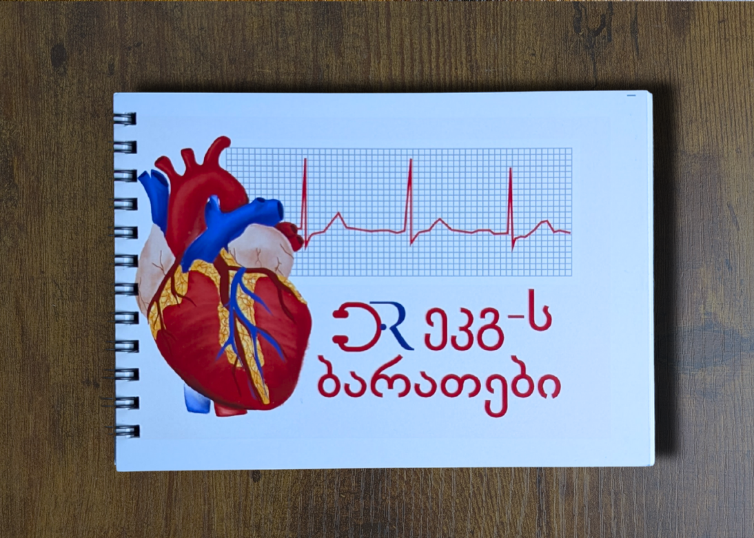 ეკგ ბარათები